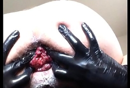 Giant Plug an Belladonna Fist Prolapse.MOV